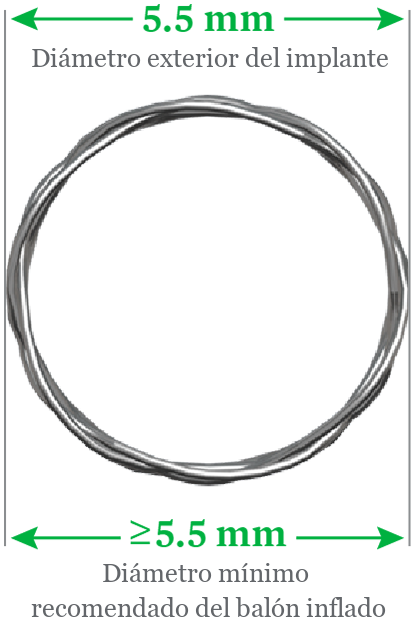 Stent sizing