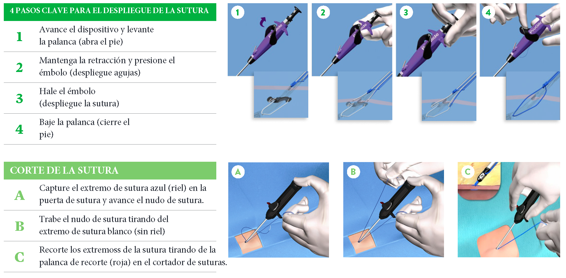 Perclose Proglide Suture-Mediated Closure System Overview | Abbott